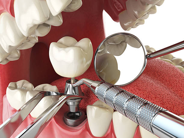 Best Emergency Dental Care for Trauma or Injury in Wesley Hills, NY